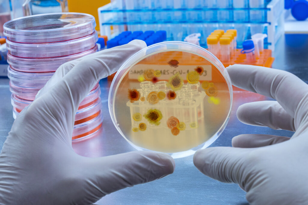 Hände mit Hygienehandschuhen halten ein Glas mit einem Virus